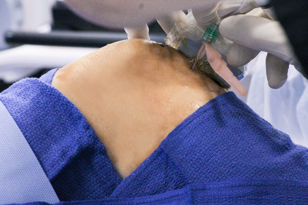 The Truth About Knee Pain